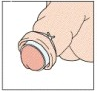 Plastibell steps - tie a string